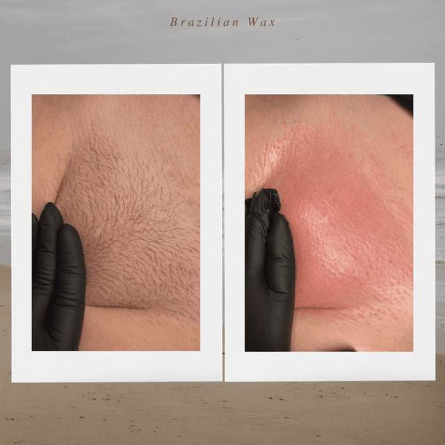New Year Brazilian Package at Carisma Esthetics in Hurst, TX